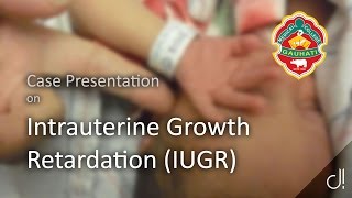 Case Presentation on Intrauterine Growth Restriction [upl. by Ekal]