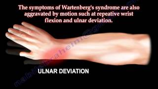 Entrapment of Radial Nerve Wartenbergs Syndrome  Everything You Need To Know  Dr Nabil Ebraheim [upl. by Kali974]