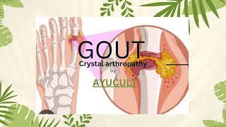 GOUT  WITHIN 15 MINUTES  STUDY MADE SIMPLE AND EASY [upl. by Carling677]