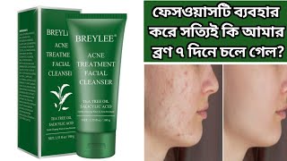 Breylee Acne Treatment Facial Cleanser Review  Breylee Acne Treatment Facewash  Breylee Facewash [upl. by Ailadgim568]