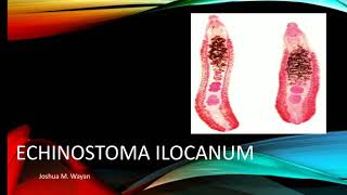 TREMATODES Echinostoma Ilocanum Joshua M Wayan [upl. by Lidah]