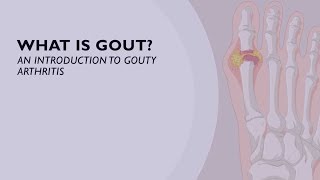 What is Gout An Introduction to Gouty Arthritis 1 of 6 [upl. by Atsylak]