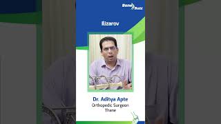 Dr Aditya Apte Speaking On Ilizarov [upl. by Garrity995]