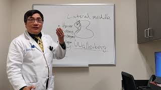 Lateral Medullary syndrome  Wallenberg syndrome [upl. by Elnora673]