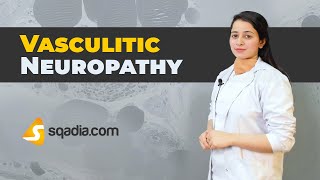 Vasculitic Neuropathy  Neurology Medicine  Video Education  VLearning™  sqadiacom [upl. by Paschasia]