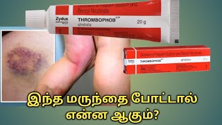 Thrombophob ointment uses in tamilThrombophob ointment benefits in tamilThrombophob ointment uses [upl. by Emawk]