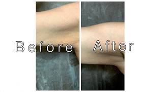 Tighten Flabby Arms amp Remove Stretch Marks [upl. by Edwine]