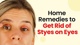 Eye Stye Solutions Rapid and Safe Treatments You Can Try Now [upl. by Amisoc]