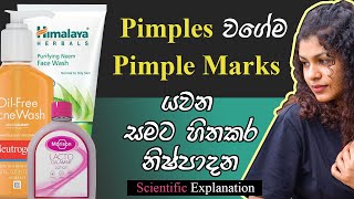 Skin Friendly Products for Get Rid from Acne  Sinhala Review කුරුලෑ වලට හොදම විසදුම [upl. by Sgninnej]