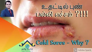 உதட்டில் புண்  பல்லி எச்சம்  Cold Sores  Why   தமிழ் [upl. by Aicaca]