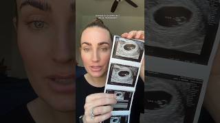 6 WEEKS PREGNANT  1st ULTRASOUND ivf ttc fertility pregnancysymptoms pregnancyjourney [upl. by Wennerholn]