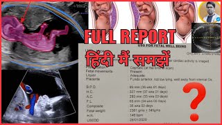 Pregnancy में पहला अल्ट्रसाउंड कब करना चाहिए  First Ultrasound In Pregnancy  Dr Mayuri Kothiwala [upl. by Rapp]