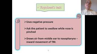 Tests for Eustachian Tube patency Valsalva manoeuvre Toynbees test [upl. by Kobe]