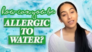 HOW CAN YOU BE ALLERGIC TO WATER  Niah Selway [upl. by Oimetra]