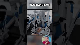 Head Transplant  Brainbridge  knowledge shorts [upl. by Etnovahs]