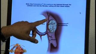 Shrinking Tumors [upl. by Ortrude]