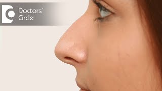 Are exercises beneficial for patients with nasal spur  Dr Lakshmi Ponnathpur [upl. by Kall]