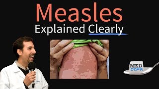 Measles rubeola Explained Clearly by MedCramcom [upl. by Hen]