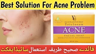 YC acne triclosan soap review  Honest Review  How to get rid of pimples  Best acne treatmentacne [upl. by Celesta]