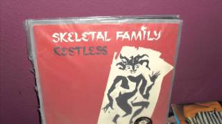 Skeletal FamilyRestless [upl. by Garlanda265]