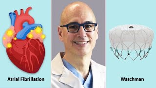 Surgeon QampA The Watchman Atrial Fibrillation amp Heart Valve Disease with Dr Marc Gerdisch [upl. by Mungam212]