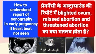 blighted ovum Incomplete or missed abortion का ultrasound रिपोर्ट मे क्या मतलब होता है [upl. by Yragerg]