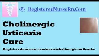 Cholinergic Urticaria Cure [upl. by Nyla]