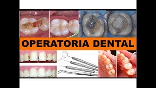 quotOPERATORIA DENTALquot por la Dra Lourdes Mejía 2 [upl. by Aiyt]