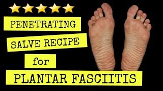 The Best Plantar Fasciitis Pain Relief Salve Recipe You Can Make at Home [upl. by Noerb521]