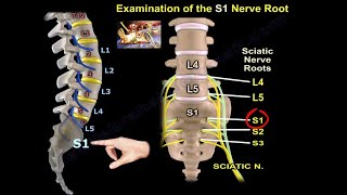 Examination Of S1 Nerve Root  Everything You Need To Know  Dr Nabil Ebraheim [upl. by Limemann124]