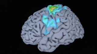 Renée Flemings Brain Scan Understanding Music and the Mind [upl. by Amri]