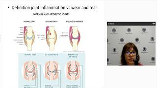 Diagnosing and managing psoriatic arthritis [upl. by Ardnot]