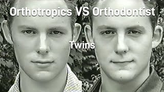 Why You Shouldnt Extract Teeth Orthotropics VS Orthodontist  Dispatches 1999 [upl. by Kiraa]