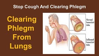 With Just 2 Tbsp Get Rid of Phlegm Accumulated Over The Years In The Lungs Chest amp Throat [upl. by Devonna]