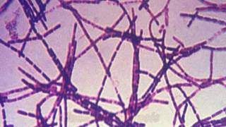 Anthrax and Bacillus anthracis [upl. by Sixel]