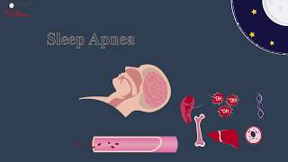 Hypertension Segment 5  Secondary Hypertension [upl. by Nonac]