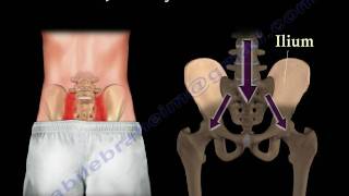 Sacroiliac Joint Dysfunction Animation  Everything You Need To Know  Dr Nabil Ebraheim MD [upl. by Asseral471]