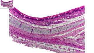 Trachea overview [upl. by Innor]