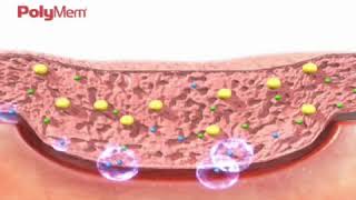 How PolyMem Wound Dressing Works [upl. by Orlantha]