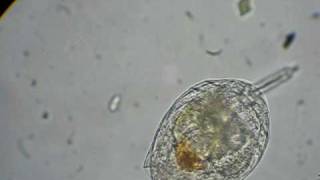 rotifer feeding on algae [upl. by Sokim61]