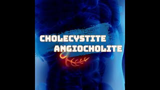 Cholecystite et Angiocholite [upl. by Schoenberg]