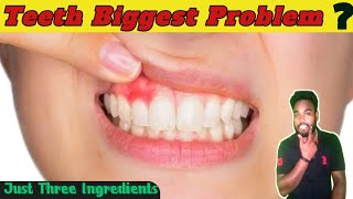 🦷Teeth 🩸Blood And Teeth All Problem🤯 Solution 🏠  Naattumarunthu  Vignesh [upl. by Onez440]