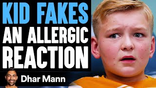 Kid FAKES ALLERGIC REACTION He Instantly Regrets It  Dhar Mann [upl. by Yesnikcm]