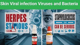 Skin viral infection  Bacterial growth  staphylococcus  Chickenpox Harpers  heart diseases [upl. by Ixel211]