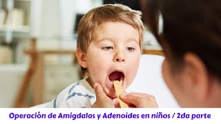 Operación de amigdalas y adenoides en niños  2da parte [upl. by Richardo]