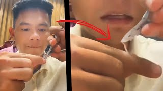 Ang pinakamasakit na NAILCUTTER FAIL Try not to watch [upl. by Reeba]