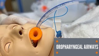 Oropharyngeal Airway Insertion [upl. by Sheena]