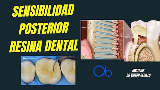 Sensibilidad Posterior a Resina Dental 🦷 [upl. by Susie110]