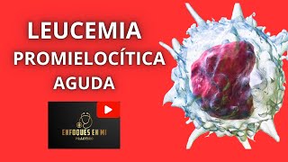 Leucemia Promielocítica Aguda Una entidad curable 🩸Enfoques en MI [upl. by Ahsael]