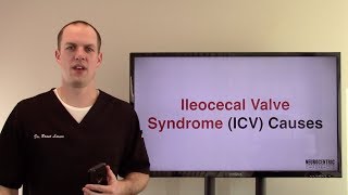 Ileocecal Valve Syndrome Causes [upl. by Nahte]